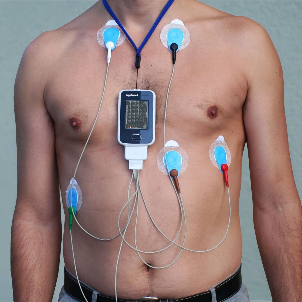 Exame Holter